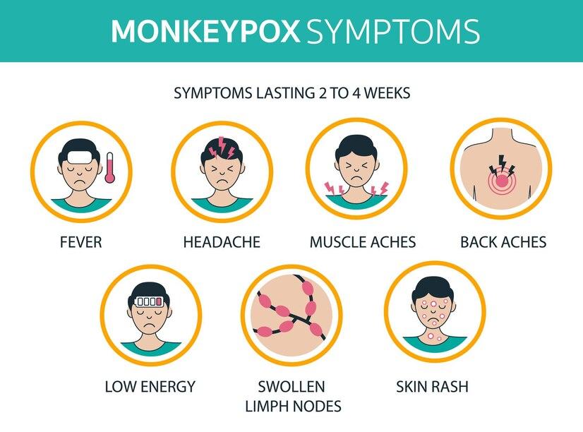 মাঙ্কিপক্স কী, যেভাবে ছড়ায়